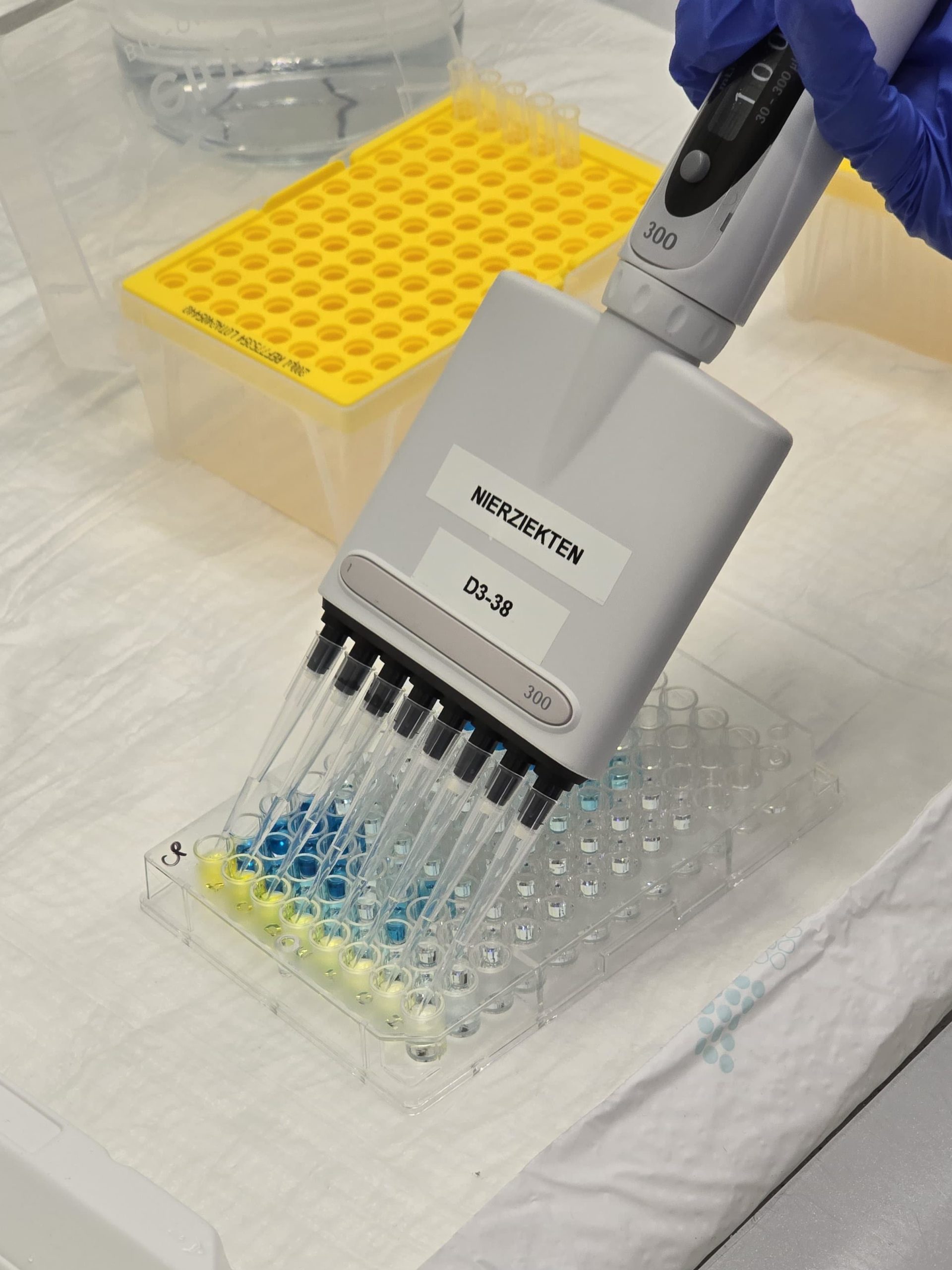 hand pipetting in a 96 well plate